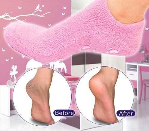 Winter Spa Gel Socks - Shopandsave